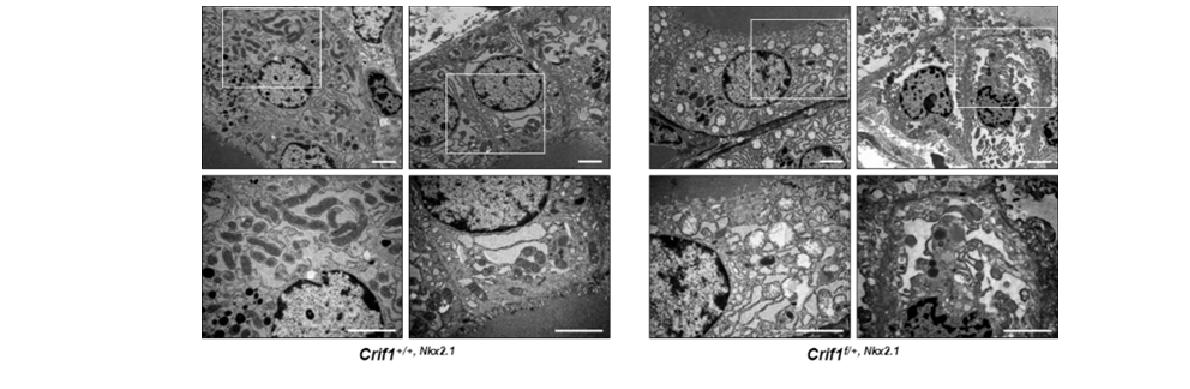 그림 80. 3주간 rhTSH 자극에 의한 갑상선 여포세포의 세포 소기관 변화