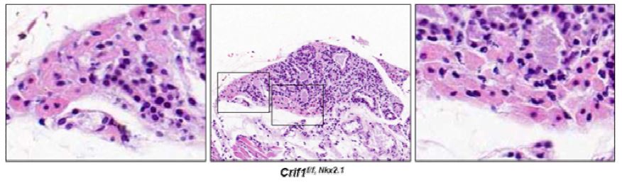 그림 82. 갑상선 특이적으로 Crif1 결손 마우스(Crif1f/f, Nkx2.1)에서 Hurthlce cell or oncocytic change