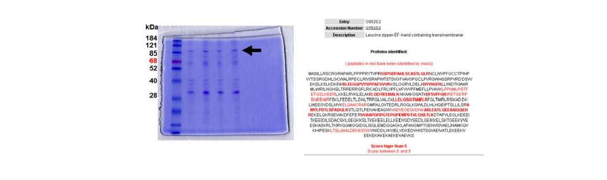 그림 91. 면역 침강방법으로 CTMP 결합 단백질 분석