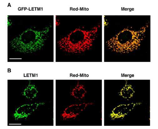 그림 93. HeLa 세포에서 CTMP 결합 단백질인 LETM1의 세포내 위치에 관한 결과