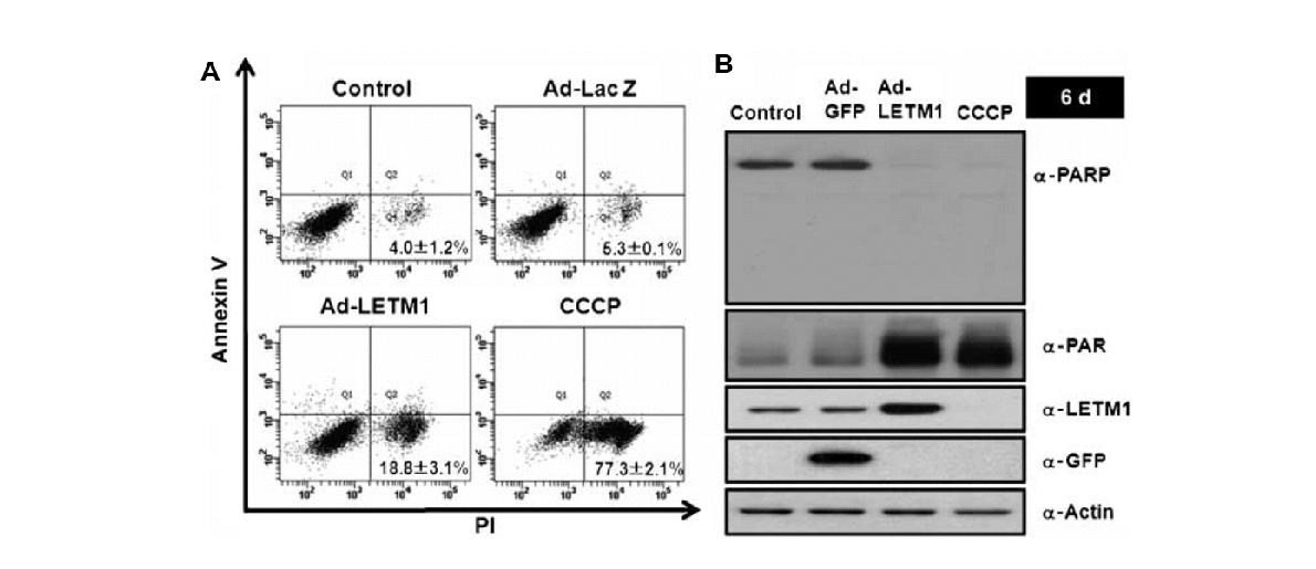 그림 98. LETM1의 과발현이 유도하는 세포사멸의 종류 확인