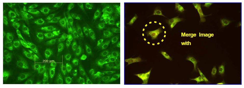 그림6. Mitochondrial localization (left) & colocalization with MitoTracker (right)