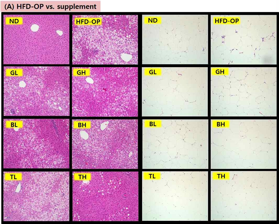 Figure 51. Hepatic and white adipose tissue morphology in C57BL/6J mice fed high-fat diet (× 200)