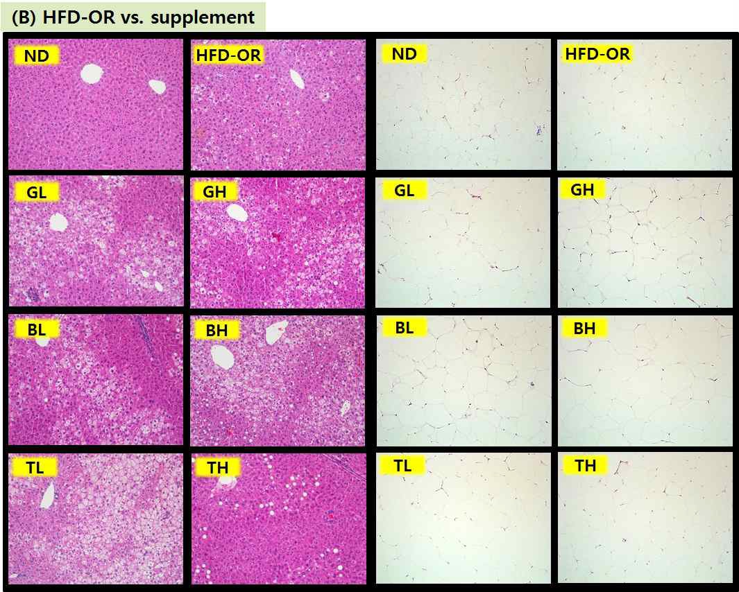 Figure 51. Hepatic and white adipose tissue morphology in C57BL/6J mice fed high-fat diet (× 200)