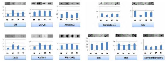 Figure 114. Comparison of expression patterns of obesity-related proteins between OP and ND/OR/OP/TH time. (A) Up-regulated and (B) down-regulated protein in OP mice