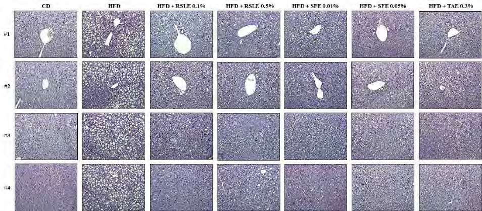 Figure 171. Effect of the RSLE, SFE and TAE on lipid acummulation in the liver from C57BL/6J mice fed with a high-fat diet