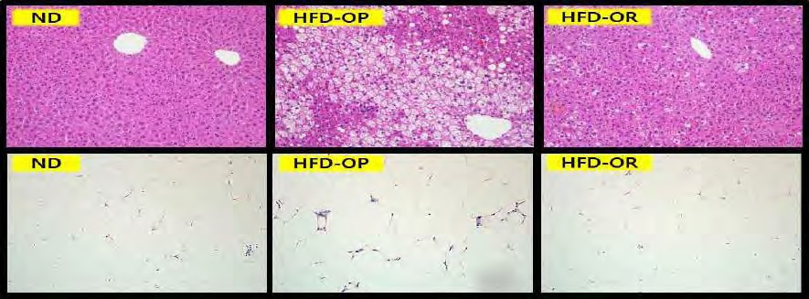 Figure 16. Hepatic and white adipose tissue morphology in obese-prone and obese-resistant C57BL/6J mice whose phenotype was observed after feeding high-fat diet for 12 weeks (× 200)