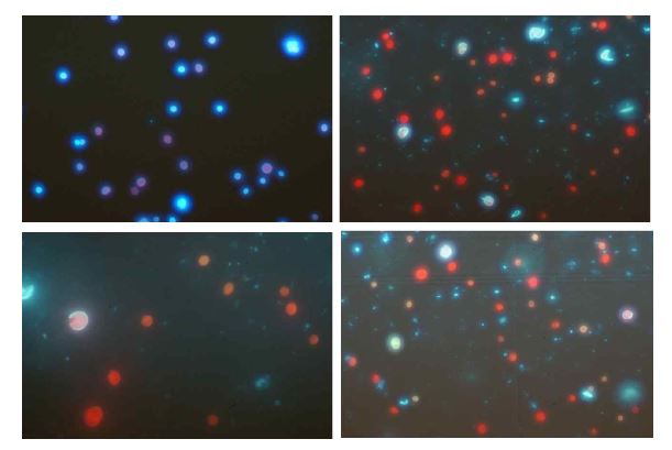 Multi enzyme 16시간 반응 후 calcoflur staining을 통해 관찰되는 protopalst cell.