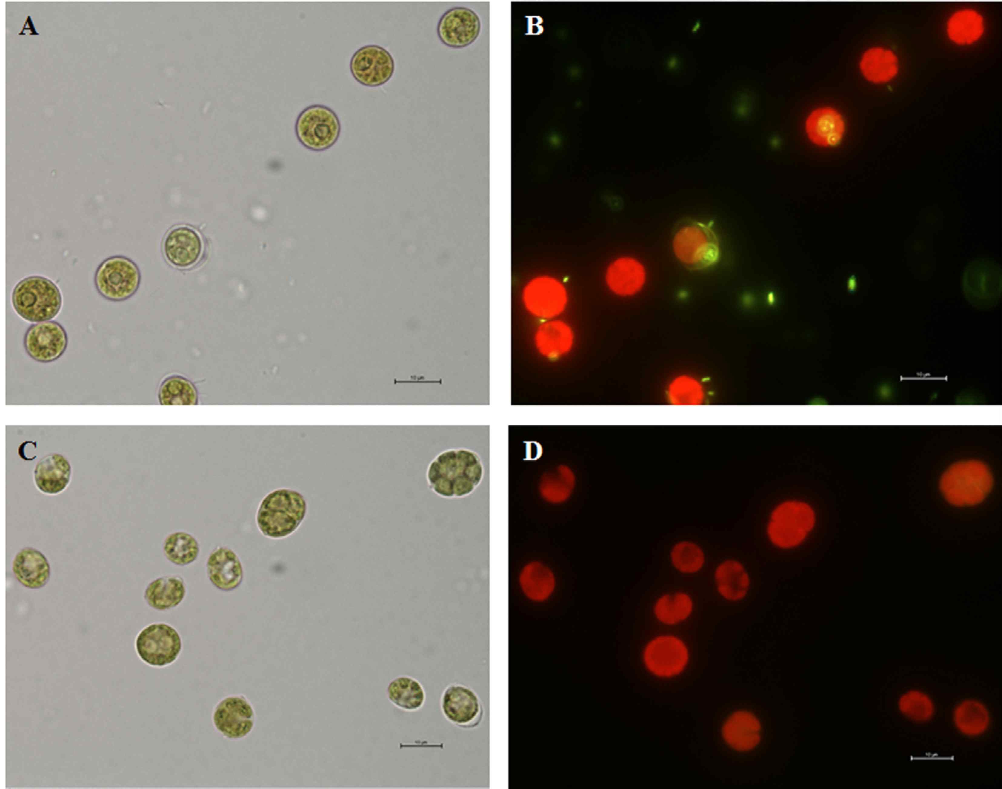 Xenic(a, b) 와 Axenic (c, d)의 SYBR green 염색 관찰