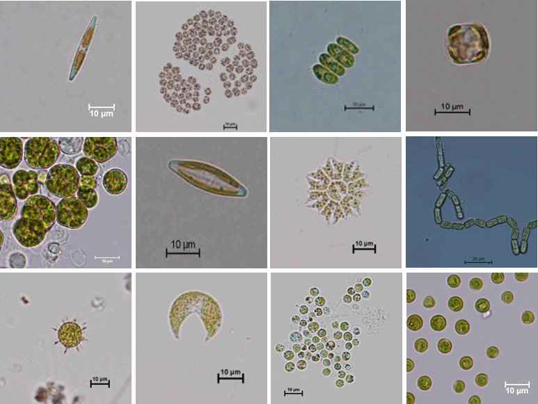 광학현미경으로 관찰된 미세조류의 사진