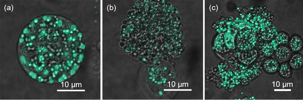 그림 8. pDMAMS 코팅 멤브레인으로 처리한 Aurantiochytrium 세포의 BODIPY 염색 사진 (형광 + bright field image). 초록색으로 염색된 부분이 염색된 lipid body. (a) 처리 전 (b) 9시간 처리 (c) 24시간 처리