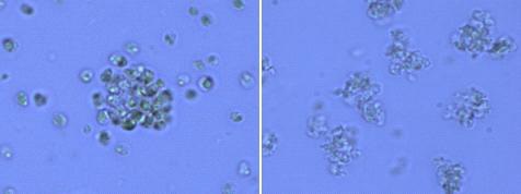 그림 1. [Bmim][CF3SO3]와 Nannochloropsis oceanica (물함량 65%)를 반응 시켰을 때 현미경 사진