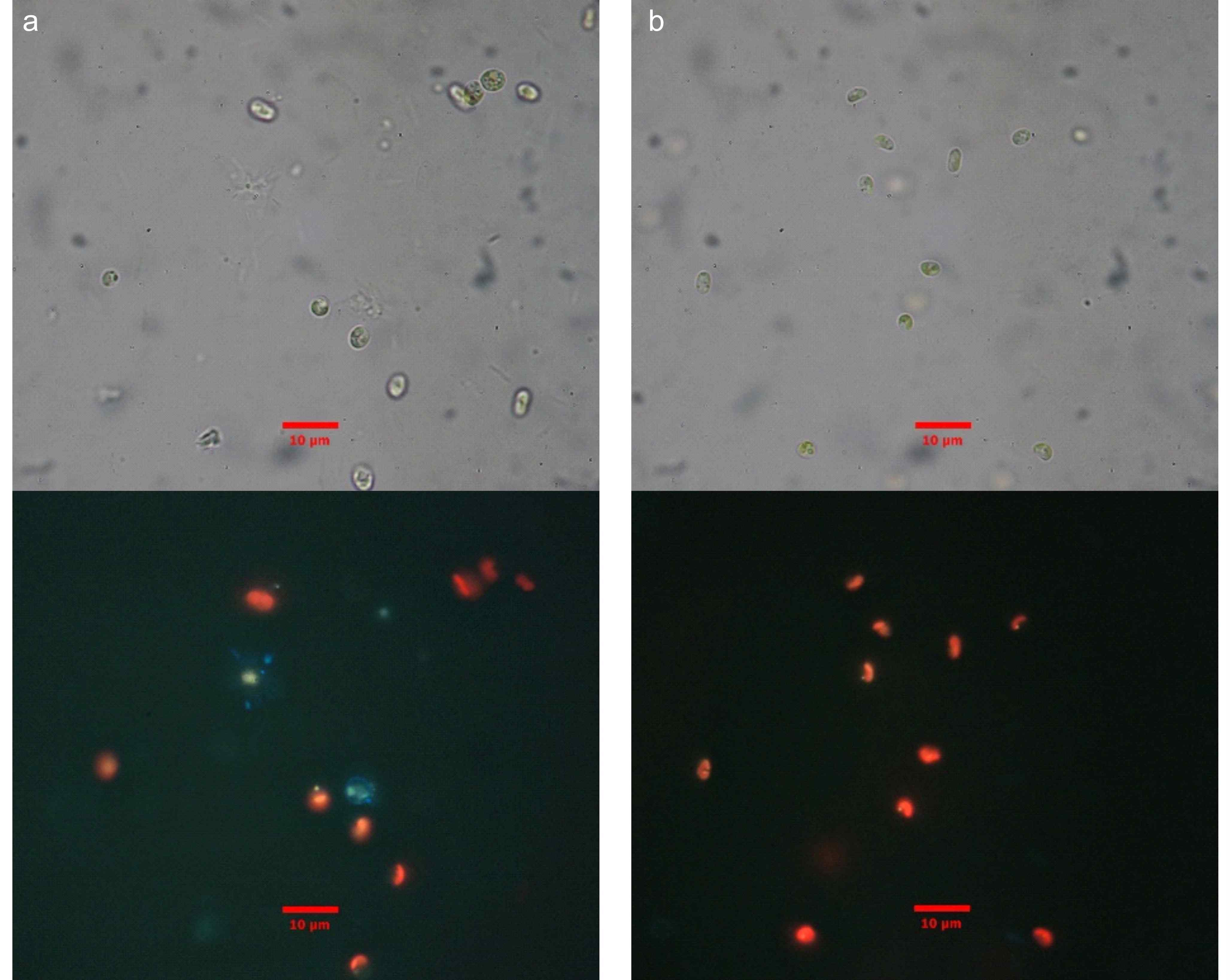 그림 6. DAPI 염색을 통해서 박테리아의 유무 확인 (a) 트리아이오다이드 처리 전 (b) 트리아이오다이드 처리 후