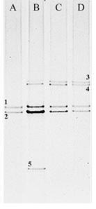 연소배가스를 이용한 Chlorella sp. KR-1의 배양시 배양액내 증폭된 박테리아 16S rRNA 유전자조각의 DGGE 패턴, A; 독립영양 조건, B; batch 혼합영양, C; fed-batch 혼합영양, D; fed-batch 혼합영양 및 dark cycle동안 air 공급. 각 밴드는 번호대로 추출하여 재증폭 및 시퀀싱 분석을 진행하였음.