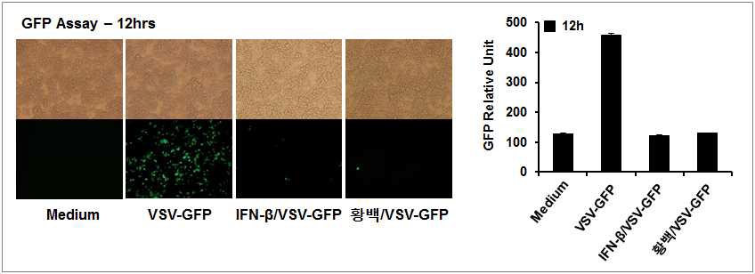 한방생약소재 황백의 항 Vesicular Stomatitis virus 효능 검증 (면역세포)