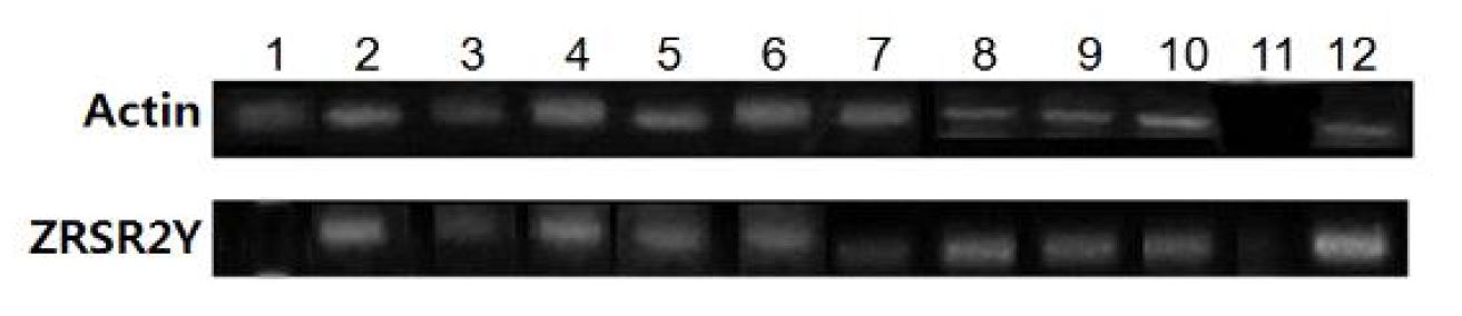 그림 1. Retuls of sexing and expression analysis in individual blastocysts by reverse transcriptase polymerase chaine reaction (RT-PCR).