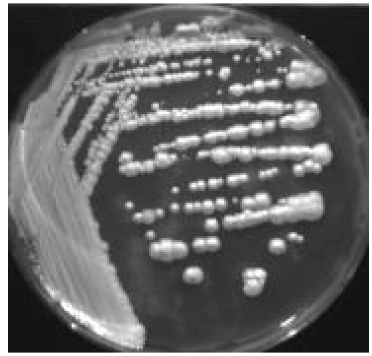 그림 6-26. 분리된 효모 Y-2의 YPD배지 내에서의 콜로니 모양 사진