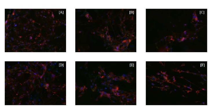 Fig. 3-2. Immunofluorescence study of the glucose transporter 4 (GLUT-4).