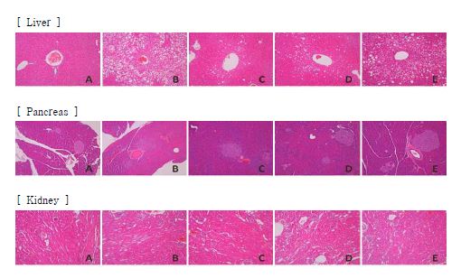 Fig. 4-5. Representative observations of histopathological lesions of liver, pancreas and kidney in C57BLKS/J-db/m+ mice (A) and C57BLKS/J-db/db mice (B-E).