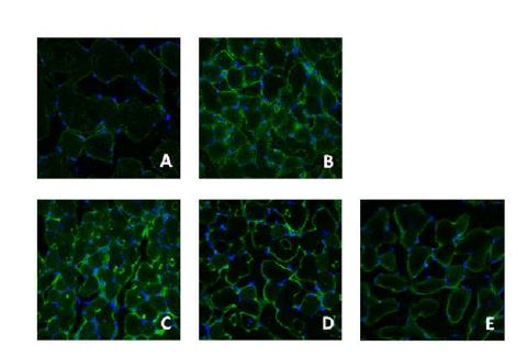 Fig. 4-9. Representative observations of skeletal muscles stained with Fluorescein sothiocyanate (FITC) for Akt in C57BLKS/J-db/db mice or C57BLKS/J-db/db mice