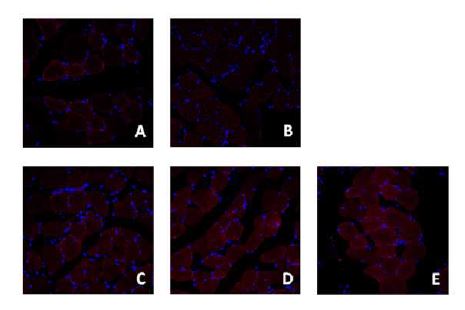 Fig. 4-10. Representative observations of skeletal muscles stained with rhodamine for phospho-Akt ser473 (pAkt) in C57BLKS/J-db/db mice or C57BLKS/J-db/db mice