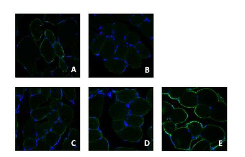 Fig. 4-11. Representative observations of skeletal muscles stained with Fluorescein isothiocyanate (FITC) for glucose transporter type 4 (GLUT4) in C57BLKS/J-db/db mice or C57BLKS/J-db/db mice