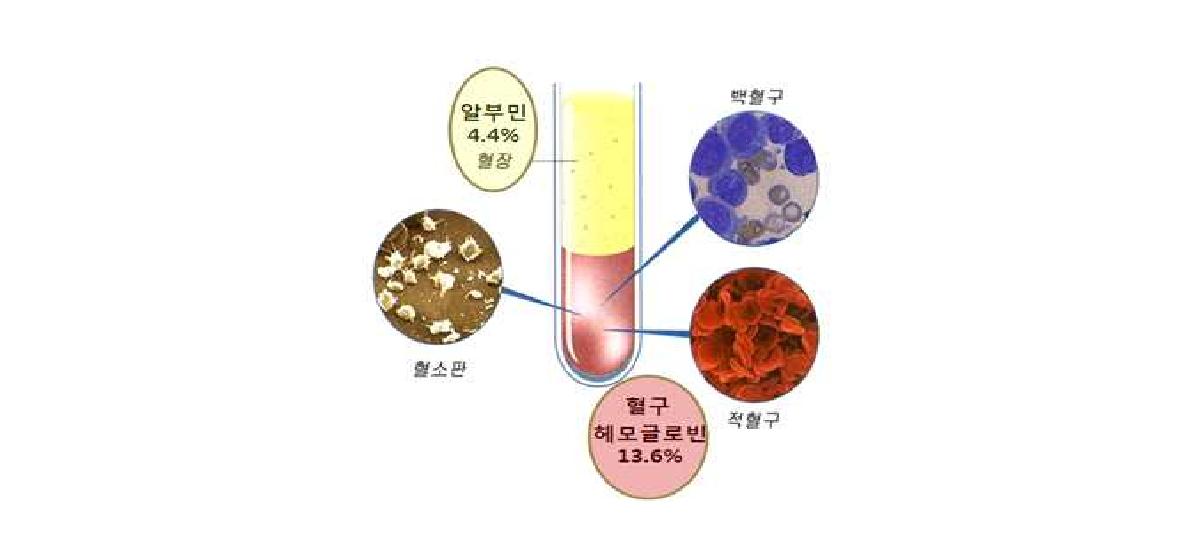 혈액을 구성하는 주요 성분