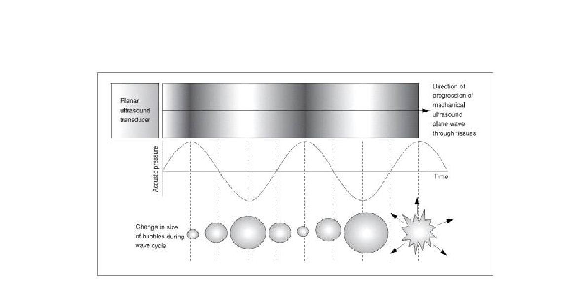 cavity의 생성과 파괴과정(cavitation)