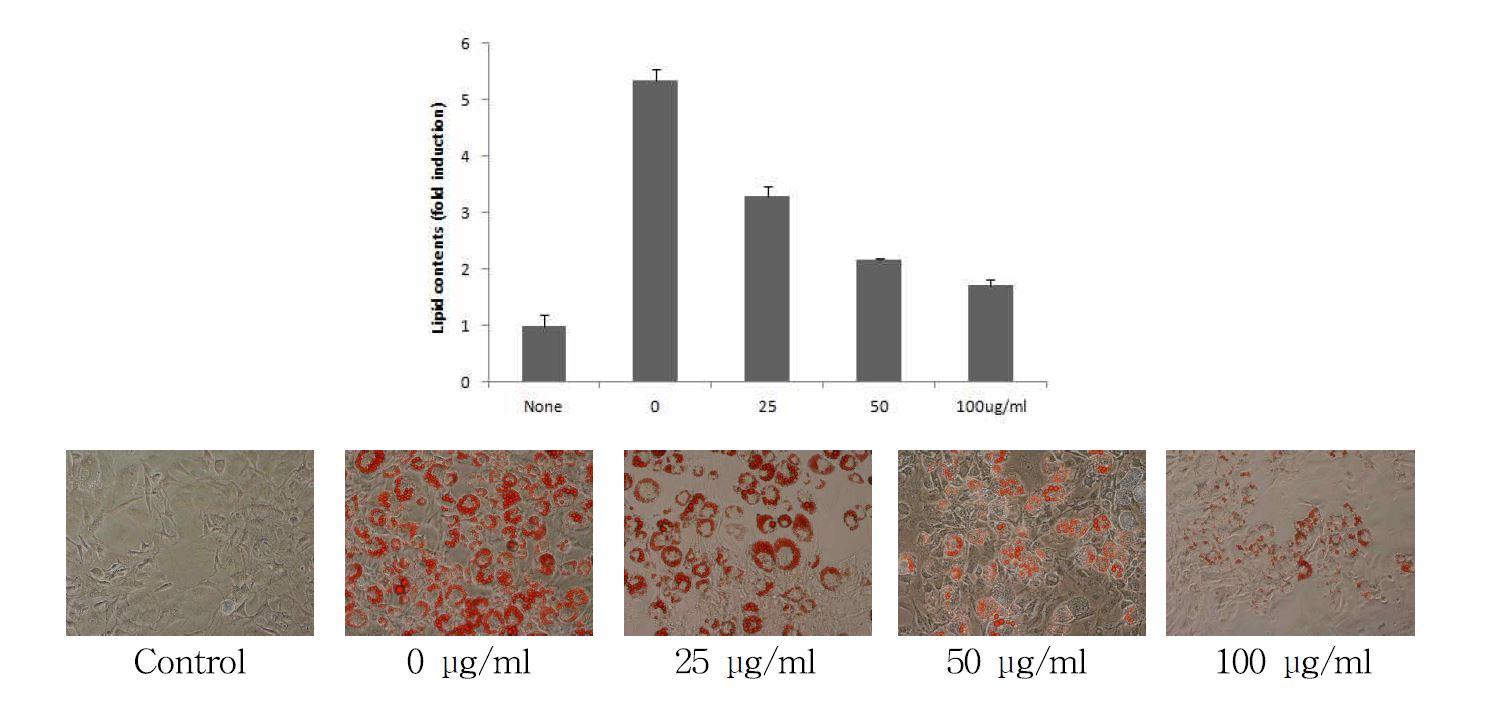 Effect of Ligularia fischeri extract on lipid accμMulation in 3T3-L1 cells.