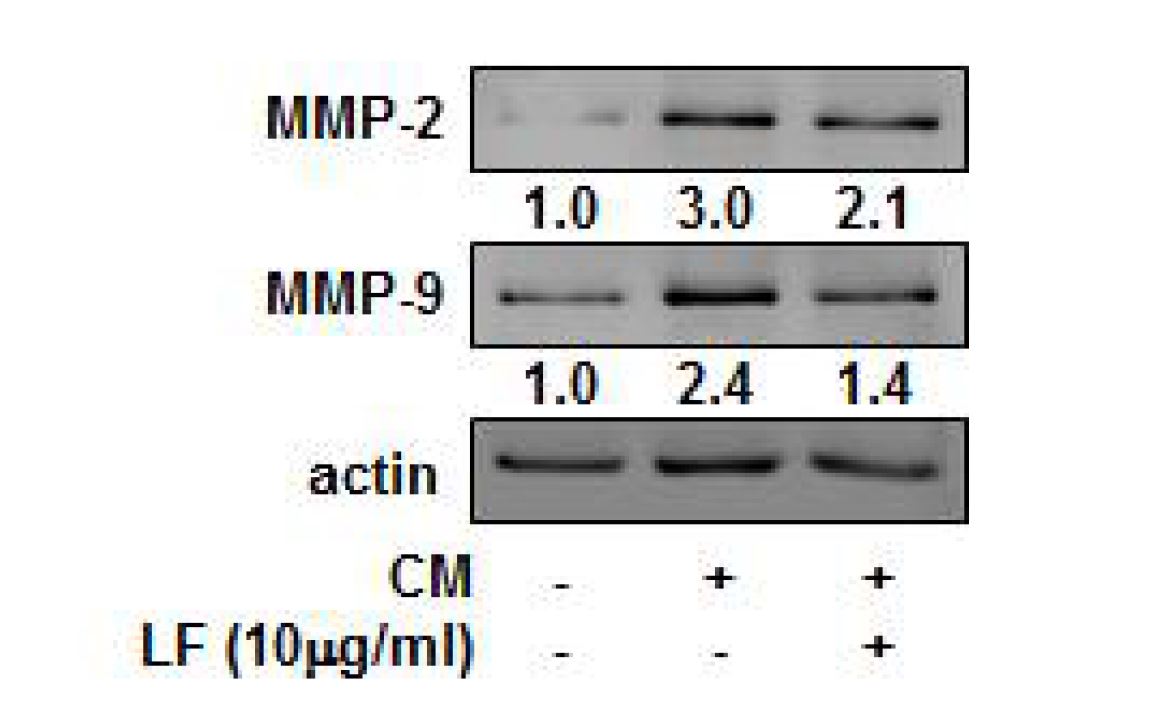 곰취 추출물에 의한 MMP 단백질 발현 제어 효과