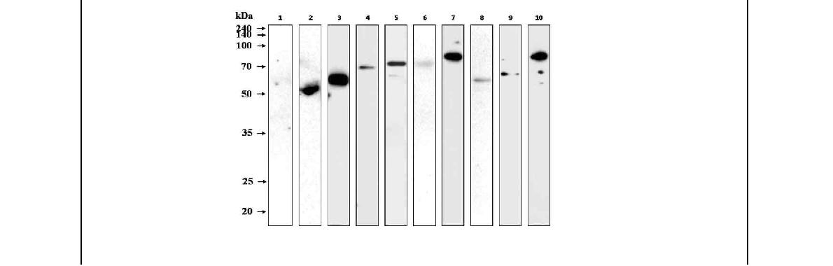 Fig.25. 목적동물(소)에서 브루셀라 균체항원 재조합단백질들의 면역원성 분석.