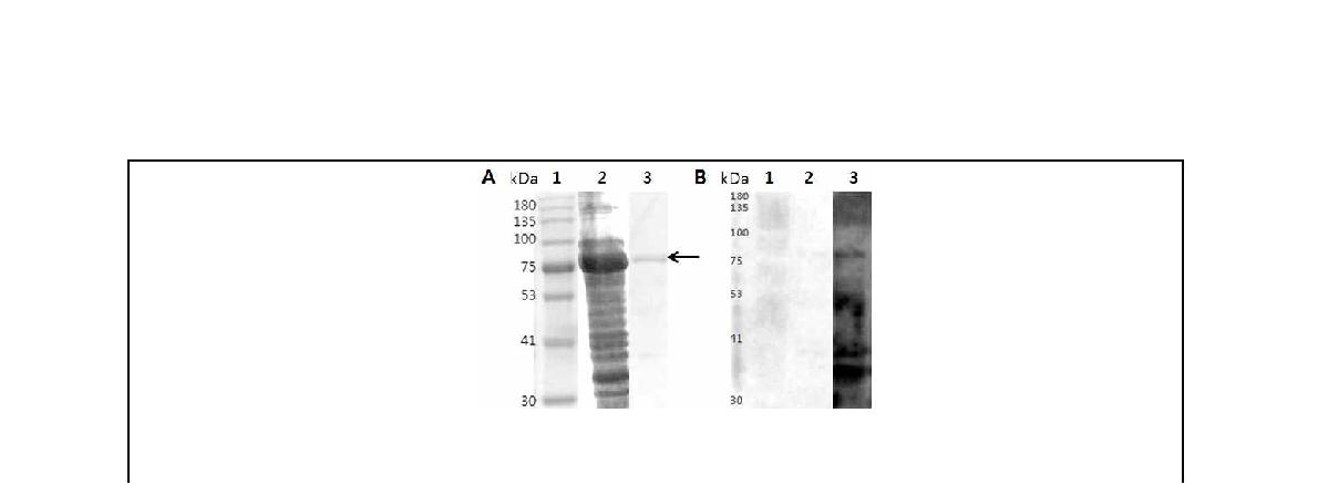 Fig. 29. 브루셀라 균체항원단백질 0628(Metal-dependent hydrolase)의 발현 및 감염 우 혈청을 이용한 면역원성 분석.