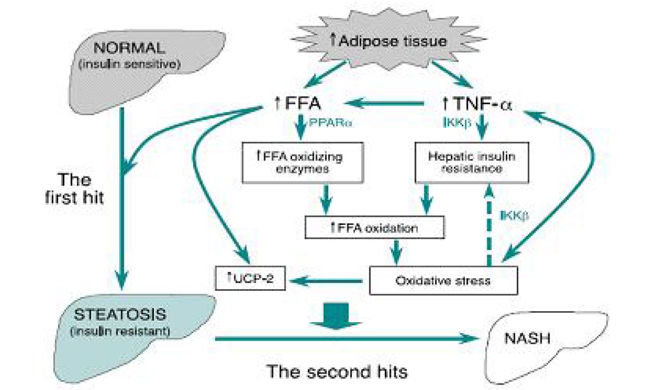 The role of TNF-a and FFA in the pachogenesis of NASH