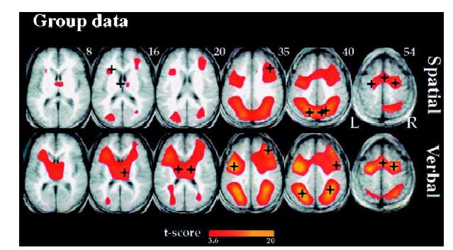 공간과 언어 자극에 따른 뇌의 활성위치
