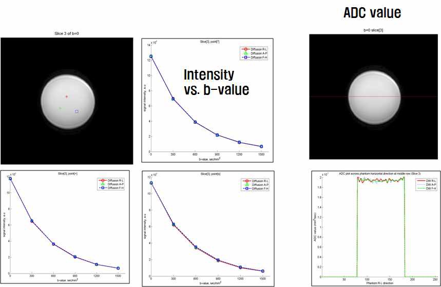 세 방향의 gradient에서 측정한 intensity vs. b-value (왼쪽) 및 ADC 값