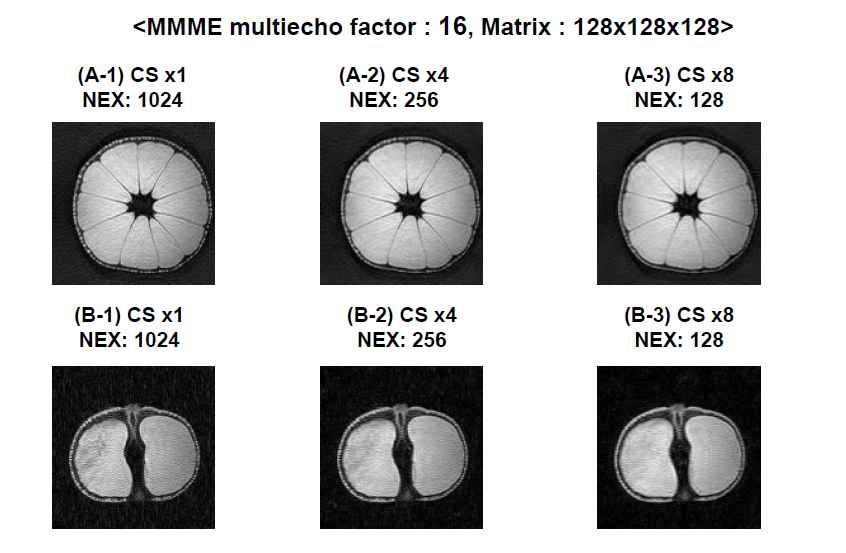 MMME 기법과 다양한 CS factor를 적용하여 얻은 귤과 감의 3D 영상들