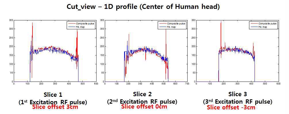 Composite RF pulse를 이용한 phase difference map, actual flip angle map 방법으로 획득한 phase difference map의 중앙부 동일 위치의 1D slice profile (volunteer)