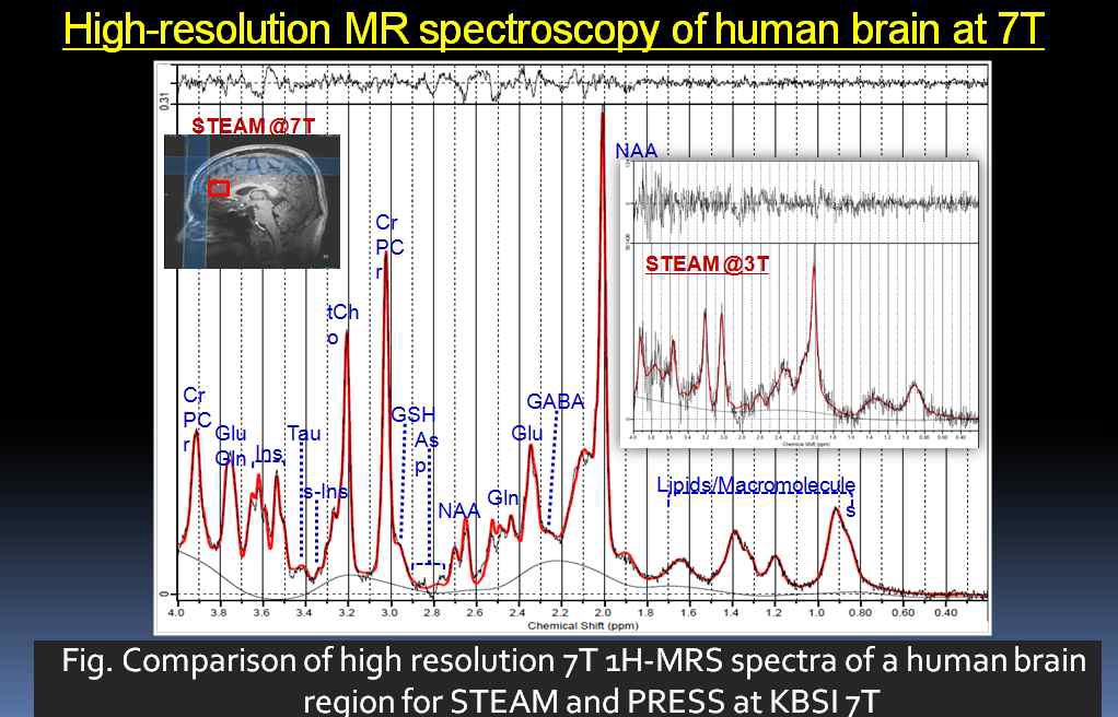 3T와 7T MRS STEAM 펄스시퀀스를 이용하여 측정한 뇌 대사물질들의 측정 및 정량분석 비교결과