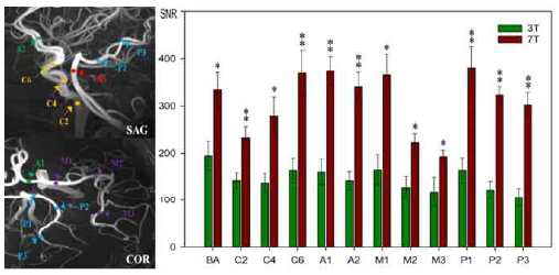 3T와 7T MRI를 이용하여 측정한 MRA primary vessel들의 SNR(signal-to-noise ratio, 신호대 잡음비) 신호강도 비교결과