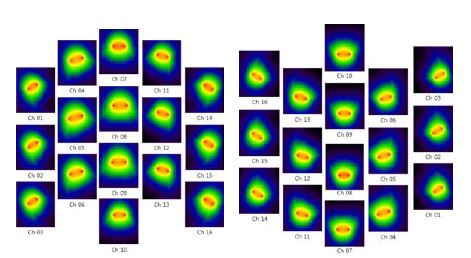 FDTD 방법을 이용한 computer simulation program으로 확인한 coil의 RF field 분포