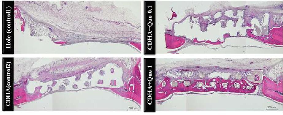 그림 22. 쿼세틴 담지 유무에 따른 골재생 양상 비교 (이식후 4주차, Rat 5mm 결손)