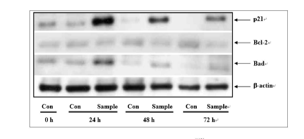 <그림 8> Effect of compound 6k on the expression of p21WAF1, Bcl-2 and Bad proteinin MDA-MB-231cancer cells.