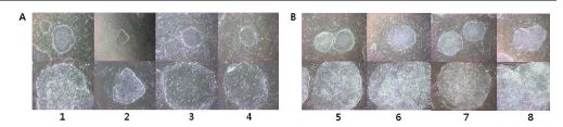 Fig. 15. Colony morphologies for hESCs with normal karyotype or abnormal karyotype