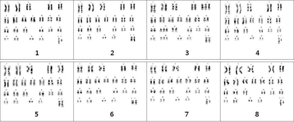 그림 16. Karyotype by G-banding.