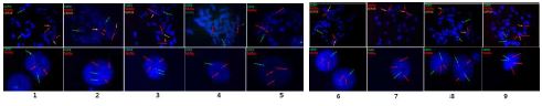 그림 17. FISH analysis for chromosome 20q in hESCs