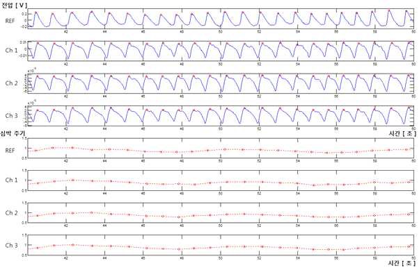 그림 15 광용적 맥파 센서를 이용한 신호 및 검출된 심박 간격 그래프.