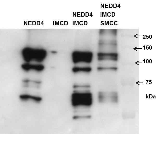 그림. SMCC에 의해 crosslinking 된 NEDD4-NEDD4 특이 기질 단백 복합체를 NEDD4 항체를 이용하여 확인함.