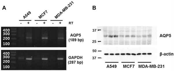 그림. 유방암 세포주인 MCF-7 세포에서의 AQP5의 mRNA (A)와 단백질 (B) 발현 확인.