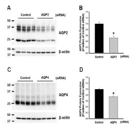그림. dDAVP-9R과 siRNA complex를 이용한 쥐의 신장 속수질 집합관에서의 AQP2 또는 AQP4의 단백 발현 조절 실험의 결과