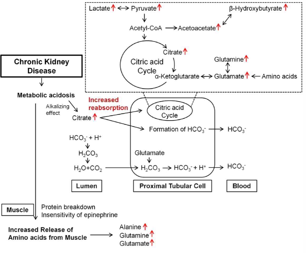 그림 A diagram for the changes in plasma metabolites in CKD.